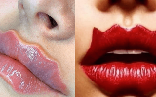 Trendul bizar al buzelor de diavol: Avertismentul experților