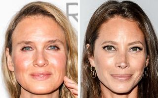 Efectul operațiilor estetice asupra vedetelor: 18 femei celebre cu și fără Botox
