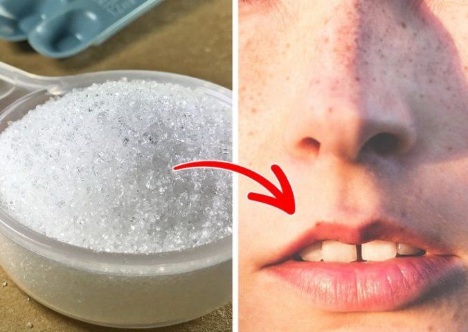 Cum să scapi de părul facial acasă, cu ingrediente naturale: 9 metode eficiente