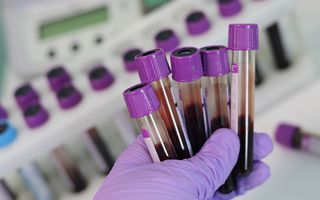 Speranță: ADN-ul mai multor tipuri de cancer ar putea fi identificat printr-un simplu test de sânge