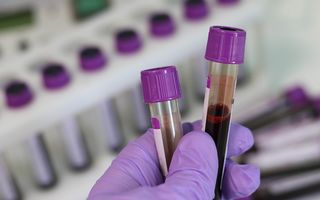 Cele mai rare grupe sanguine – Totul despre compatibilități, antigeni și “sângele de aur”