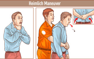 Manevra Heimlich, salvatoarea de vieți, ar trebui să fie cunoscută de toată lumea