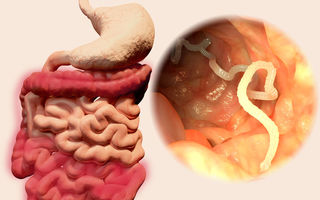 Tenia: cum ajunge în organism, cum pătrunde în sânge și ce riscuri reale implică