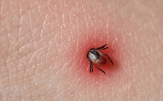 Mituri despre boala Lyme: ce nu e adevărat, dar continuă să se creadă