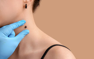 Ce simptome nu trebuie să le tratezi cu „lasă că trece de la sine”