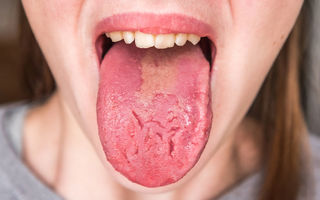 Ce îți spune limba despre sănătatea ta: semne pe care nu trebuie să le ignori