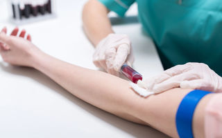 Bilirubina crescută sau scăzută: ce înseamnă analizele și când ar trebui să te îngrijoreze