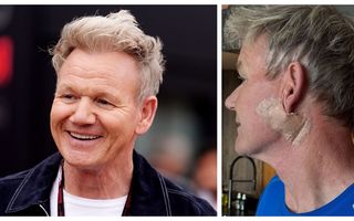 Gordon Ramsay, față în față cu cancerul de piele: lecția dură pe care o dă lumii