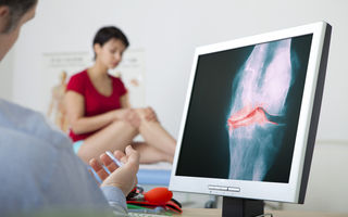 Gonartroza – cauze, simptome și tratamente care pot ameliora durerea articulară