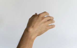 Cel mai rapid tratament naturist pentru lipoame – remedii eficiente pentru eliminarea nodulilor de grăsime