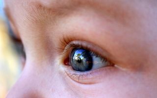 Enteroviroza la copii – simptome, cauze și tratament