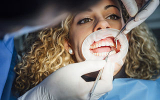 Ce este anodonția: cauze, semne și ce poți face dacă te naști fără unii dinți