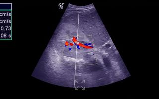 Ecografia cardiacă Doppler: ce este, când se recomandă și ce informații oferă