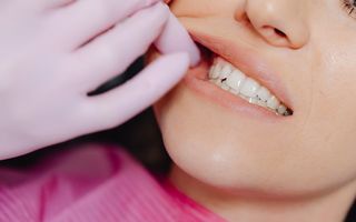 Abces dentar: tratament acasă și ce NU trebuie să faci