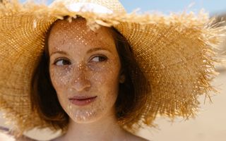 Soluții naturiste pentru petele pigmentare de la soare. Ce poți încerca acasă și când trebuie să mergi la dermatolog