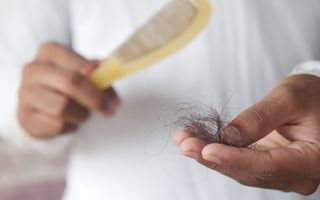 Când este normală căderea părului și când trebuie investigată. Semnele care nu ar trebui ignorate