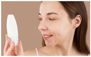 Ce produse să eviți dacă ai ten acneic. Dermatologii atrag atenția asupra unor greșeli care pot agrava coșurile