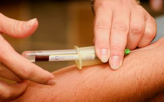 Ce analize se fac pentru splină. Investigațiile recomandate când există dureri, splină mărită sau analize modificate
