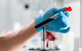 Ce analize merită făcute anual după 40 de ani. Ce trebuie verificat și ce teste nu este nevoie să repeți în fiecare an