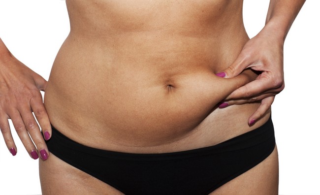 Pierde în greutate după abdominoplastie. Sarcina dupa abdominoplastie | Art Estetica by Dr. Rachad